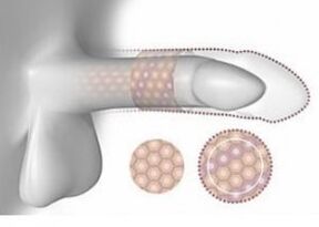 Enlarged penis in volume